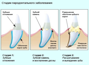 nalet1.jpg