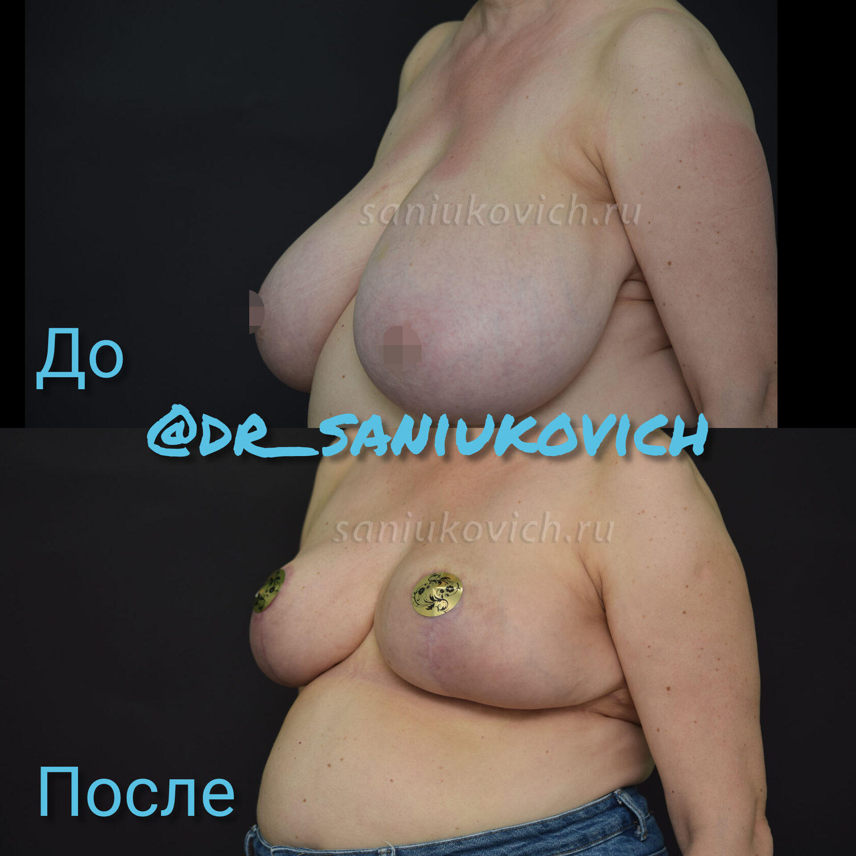 уменьшается грудь во время беременности фото 65