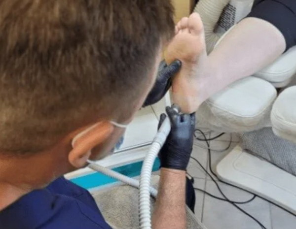 обработка трещин и мозолей на стопах