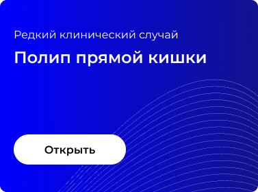 ПОЛИП ПРЯМОЙ КИШКИ