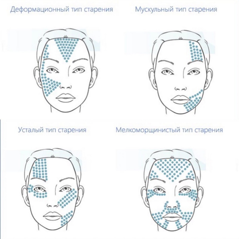 Аквашайн схема как колоть