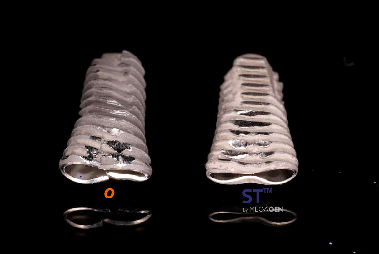 Слева имплантат фирмы О (более темная поверхность SLA), справа имплантат MegaGen ST. Сплав не дал фрактуру, даже при полном сдавлении