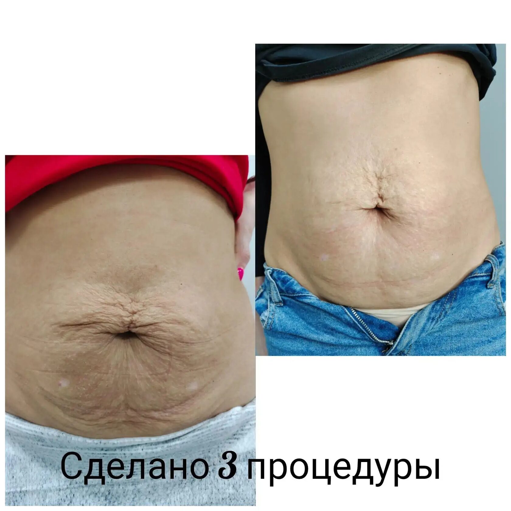 Результат 3