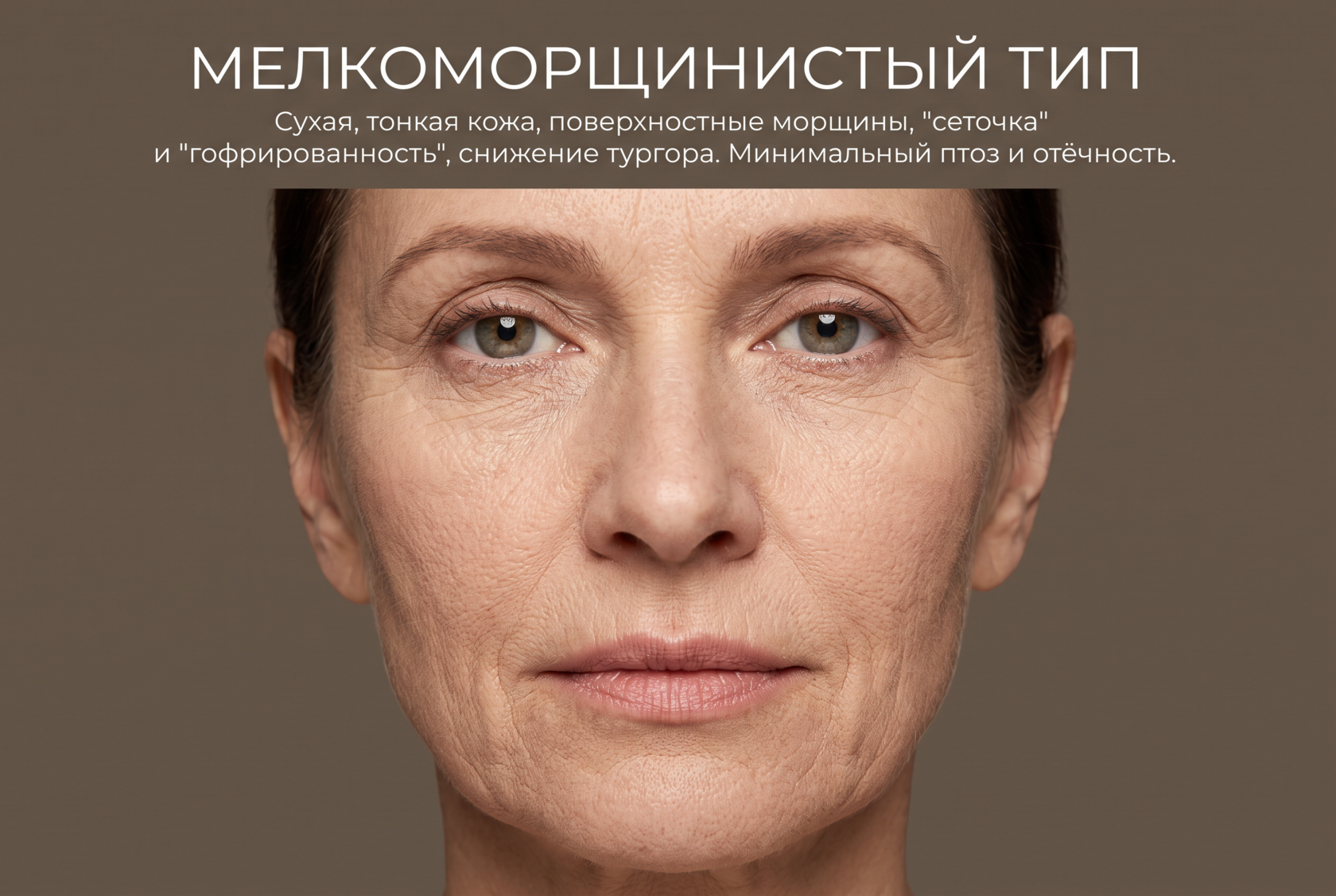 Мелкоморщинистый тип старения кожи лица