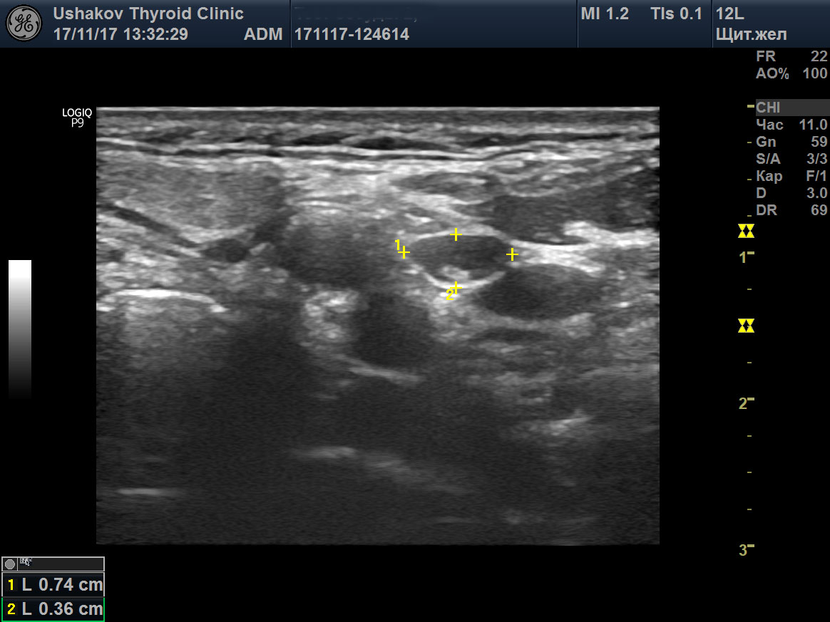 Узи шейного отдела москва