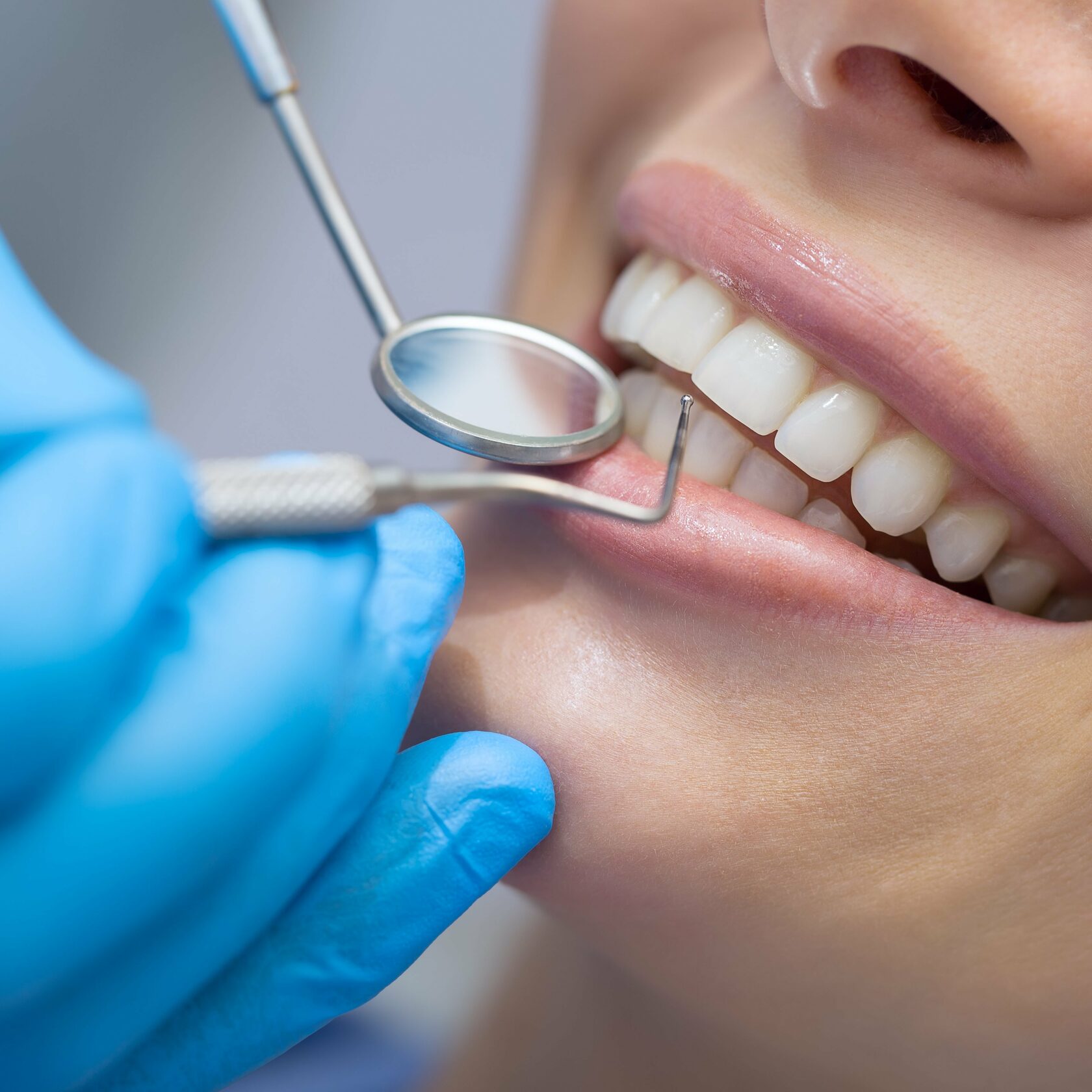 Гигиена десен. Профессиональная гигиена полости рта. Профессиональная гигиена полости рта в стоматологии. Красивые зубы стоматология. Сайт стоматологии.