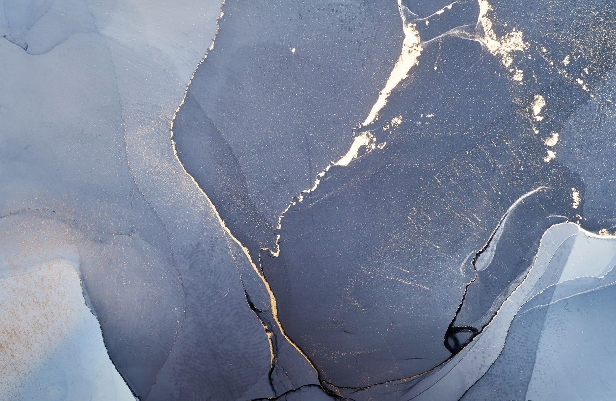 «Пигментный ретинит. Клиника. Диагностика. Лечение.»