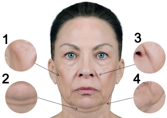 Какая процедура подойдет Вам? Клиника инновационных медицинских ...