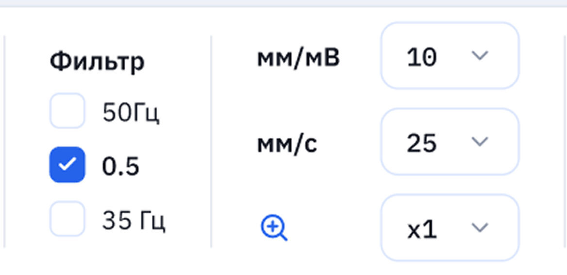 Настройки мм/мВ, мм/с и масштаба