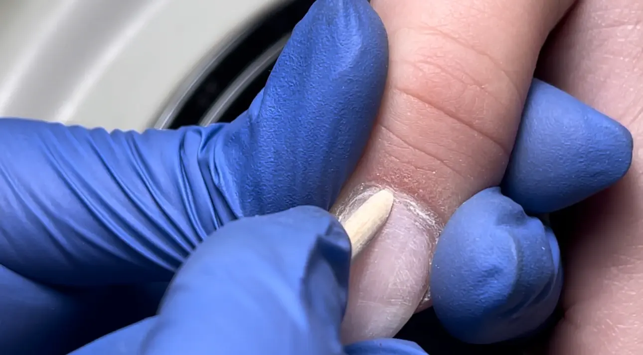 выбрав правильную технику работы с кутикулой не будет ошибки как на фото идеально раскрытый карман кутикулы при комби маникюре, техника Александры Данграс, чистый и безопасный маникюр без склеек