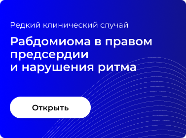 РАБДОМИОМА В ПРАВОМ ПРЕДСЕРДИИ И НАРУШЕНИЯ РИТМА
