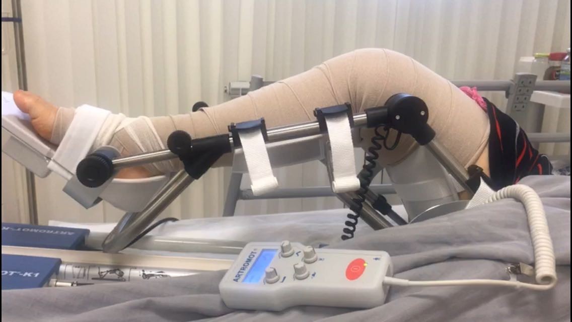 Восстановление после операции на коленном. Механотерапия Артромот. Аппарат ARTROMOT. Германские аппараты механотерапии «Артрамот. Артромот для коленного сустава.