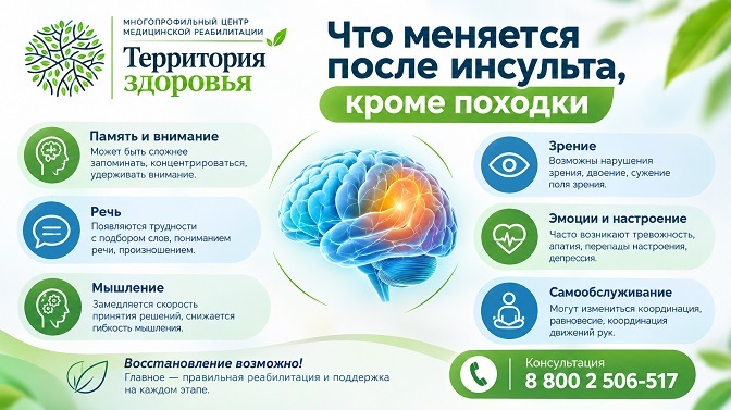 Что меняется после инсульта, кроме походки