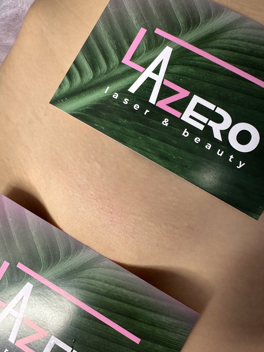 Гладкая кожа после лазерной эпиляции в LA ZERO