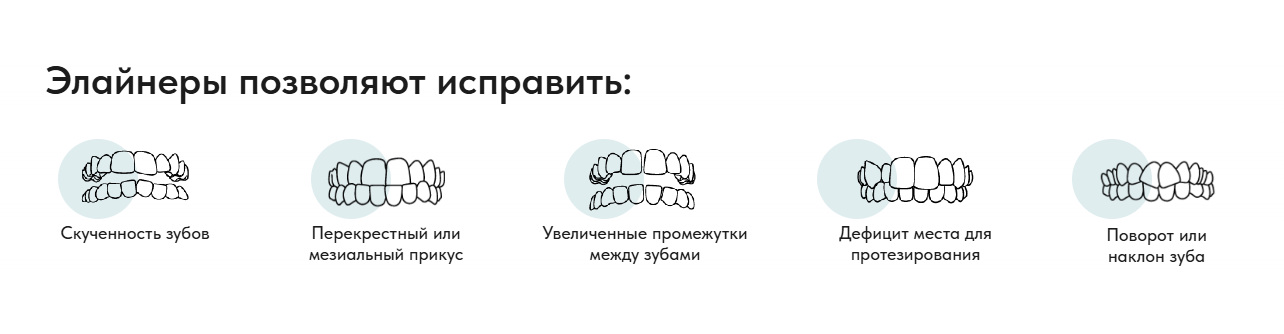 Блок с ситуациями, которые могут корректироваться элайнерами