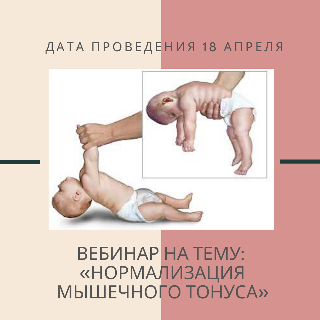 Гипотония у новорожденного. Мышечный гипертонус. Типы нарушения мышечного тонуса. Тонус мышц. Гипертонус мышц.