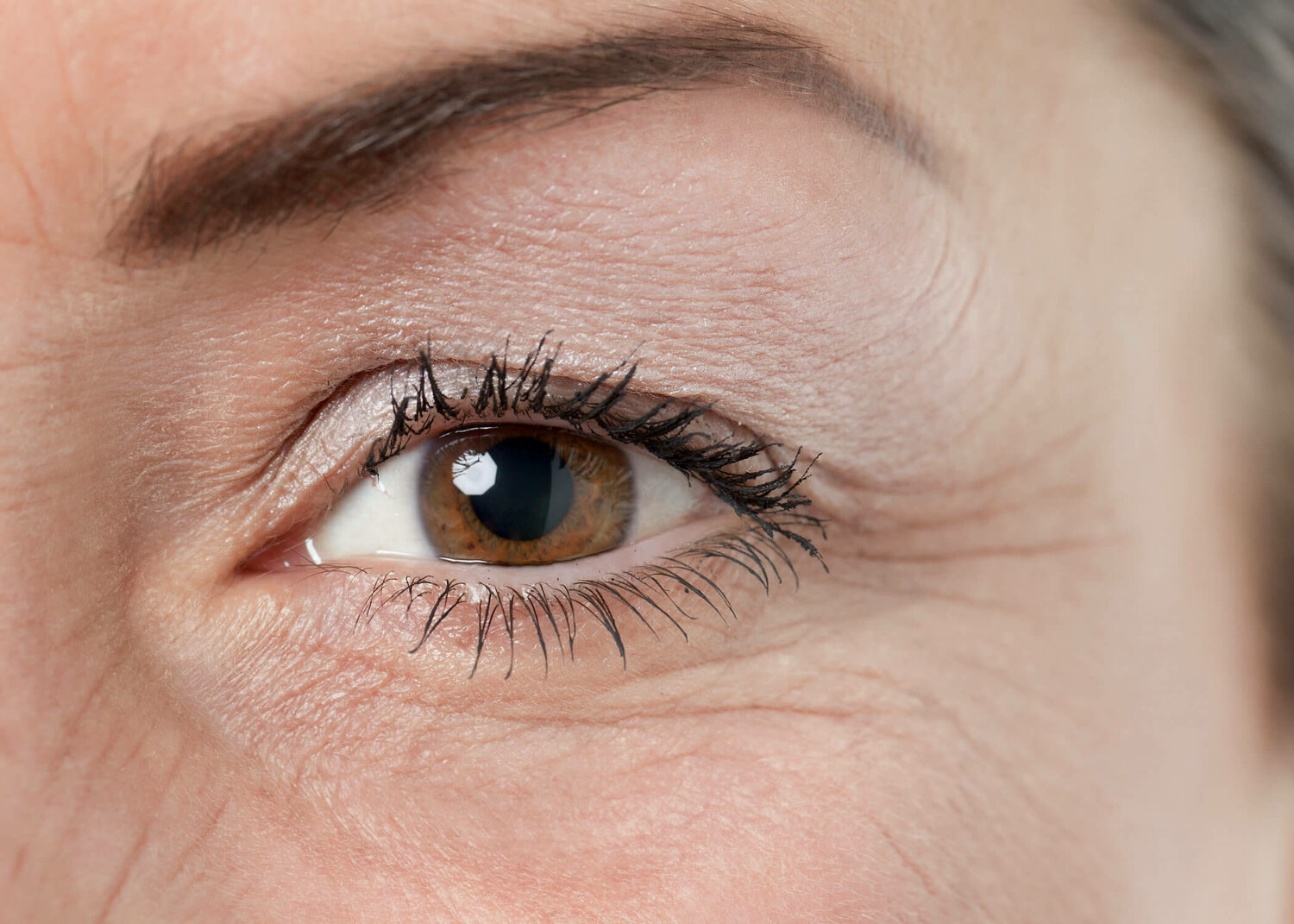 Мимические морщины. Маленькой морщинки. Маленькой морщинки. Маленькие морщины под глазами. Маленькой морщинки.