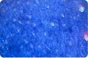 Cross-Polarized Light