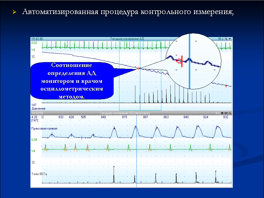 Контрольное измерение