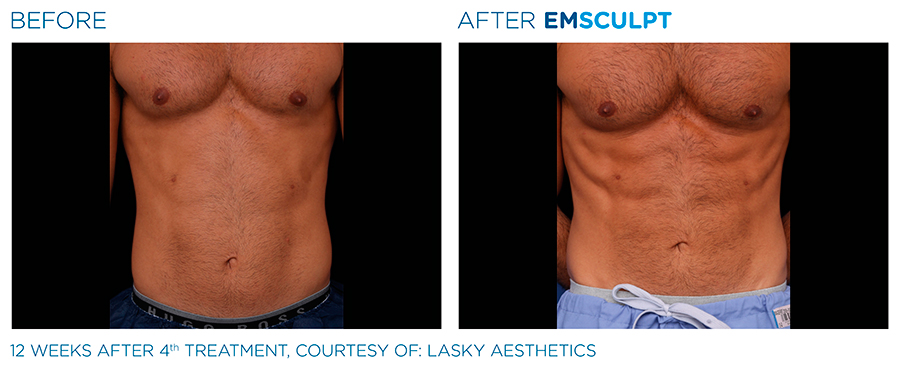 Услуги массажа в Химках: 4 массажиста