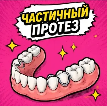 Частичный пластиночный протез