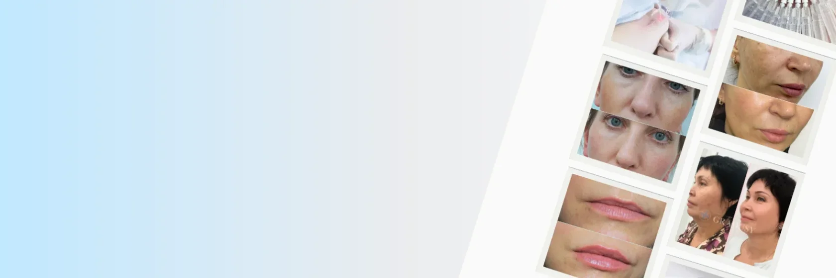 фото работ косметология
