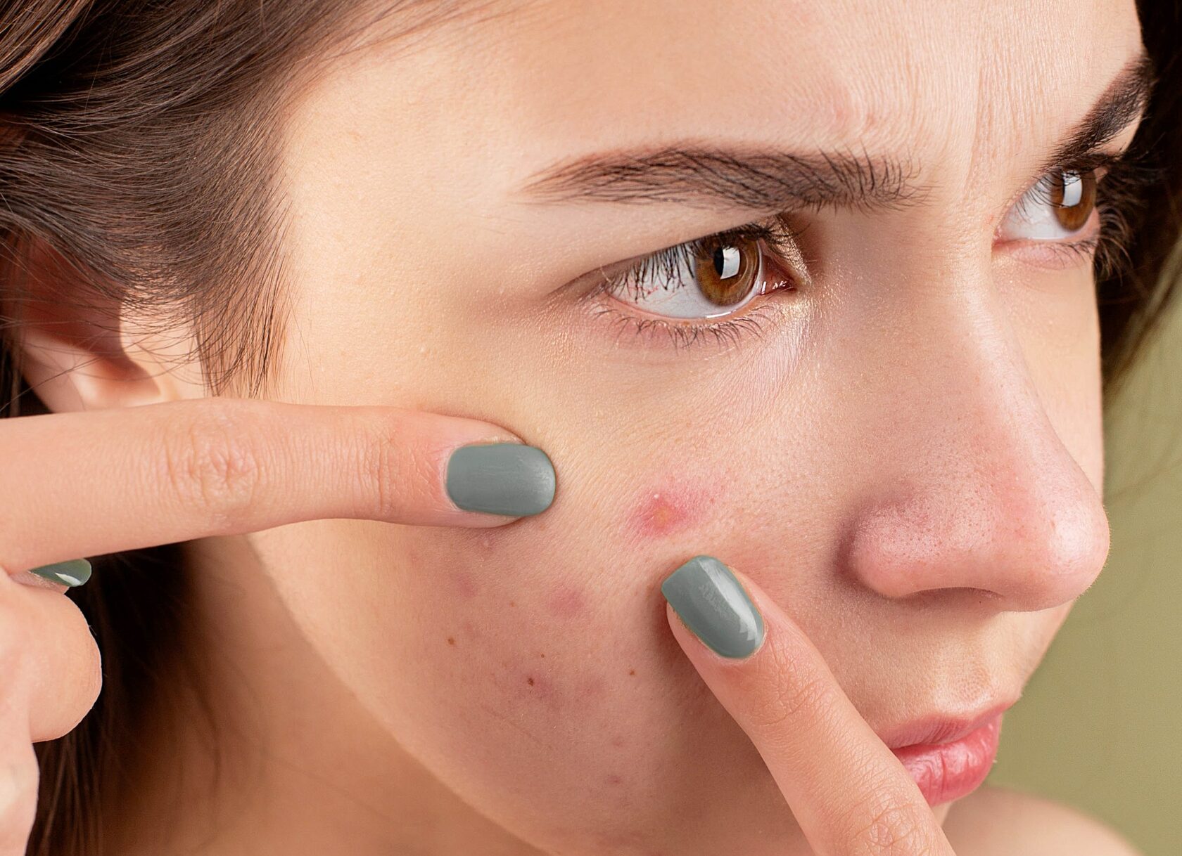 Раздражение кожи на лице: причины и способы лечения