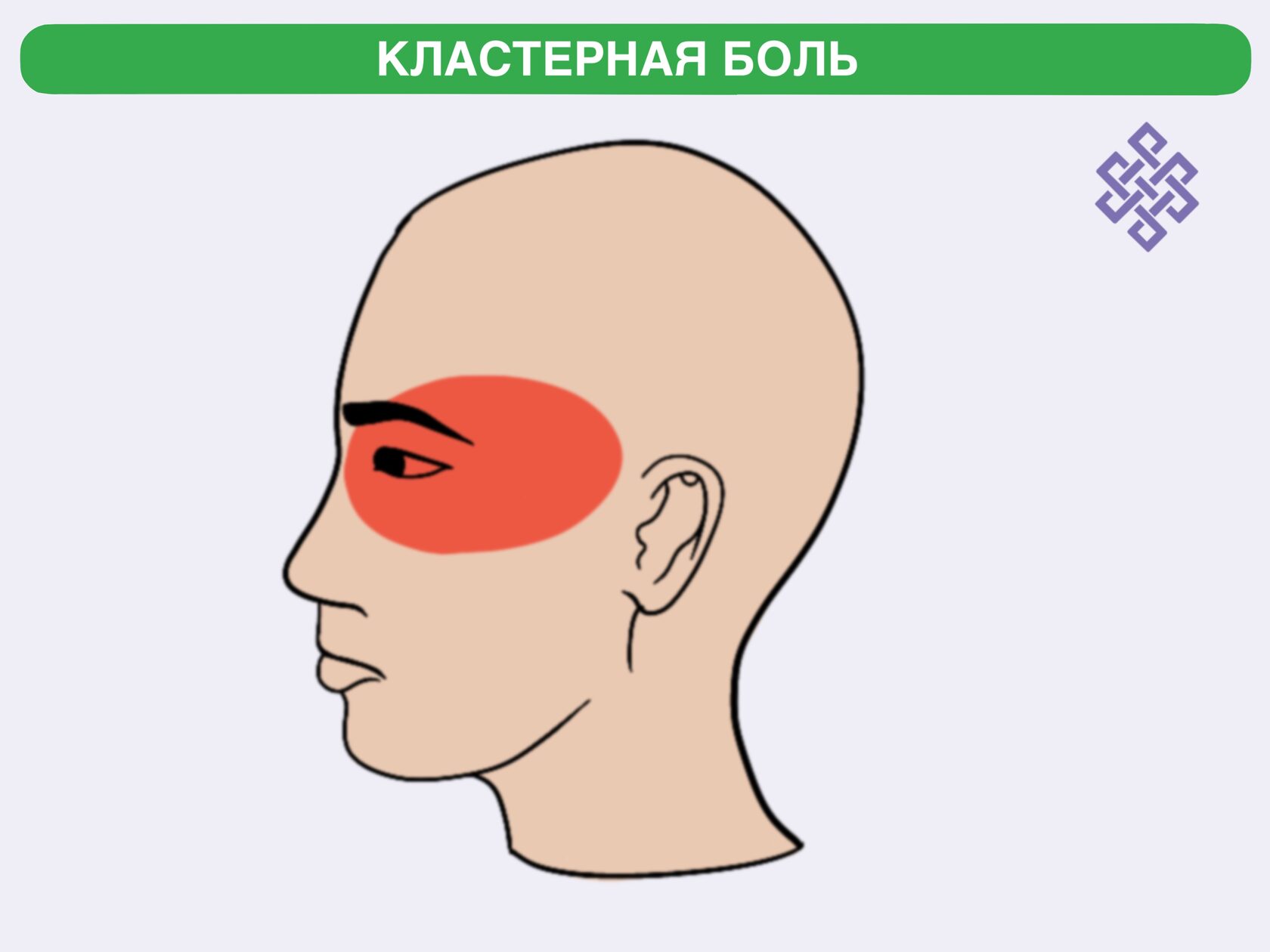 Боль в затылке с правой стороны головы