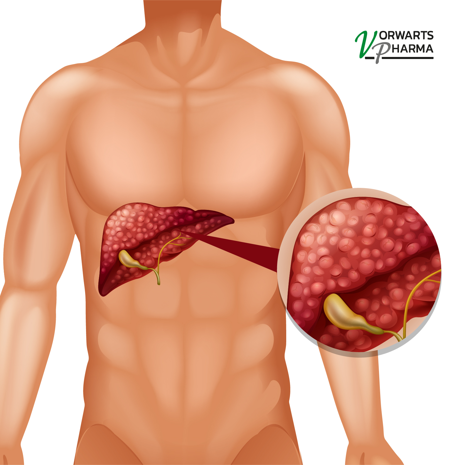 Signs of gallbladder disorders. How to identify the problem