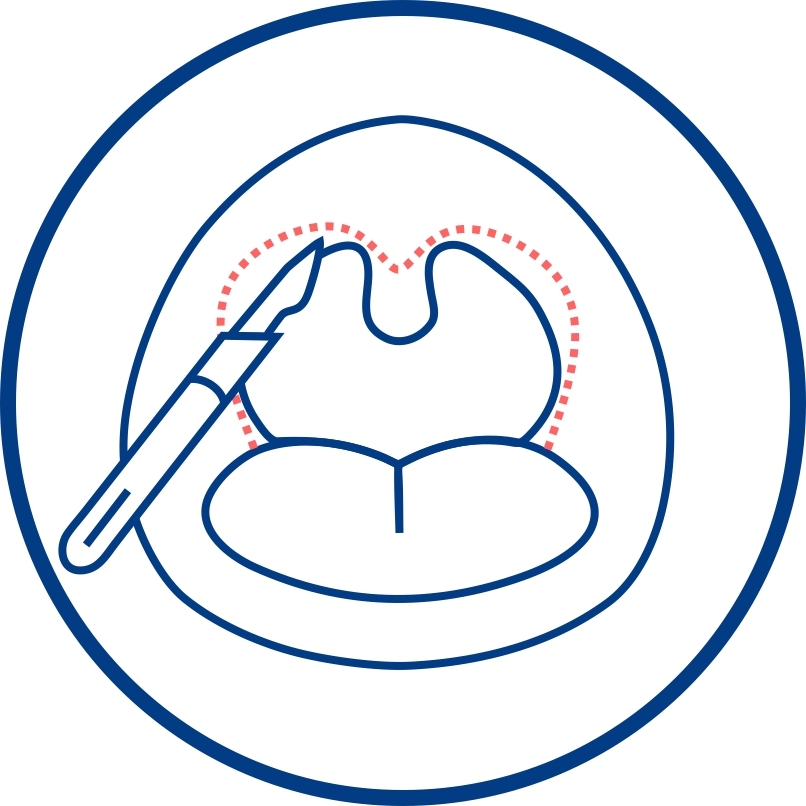 Bipap-терапия и что такое BiPAP-терапия? Его отличие от СИПАП-терапии