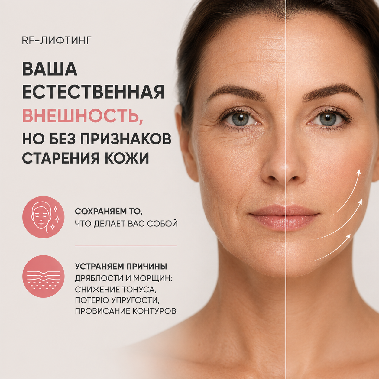 Красивая кожа лица — результат RF-лифтинга