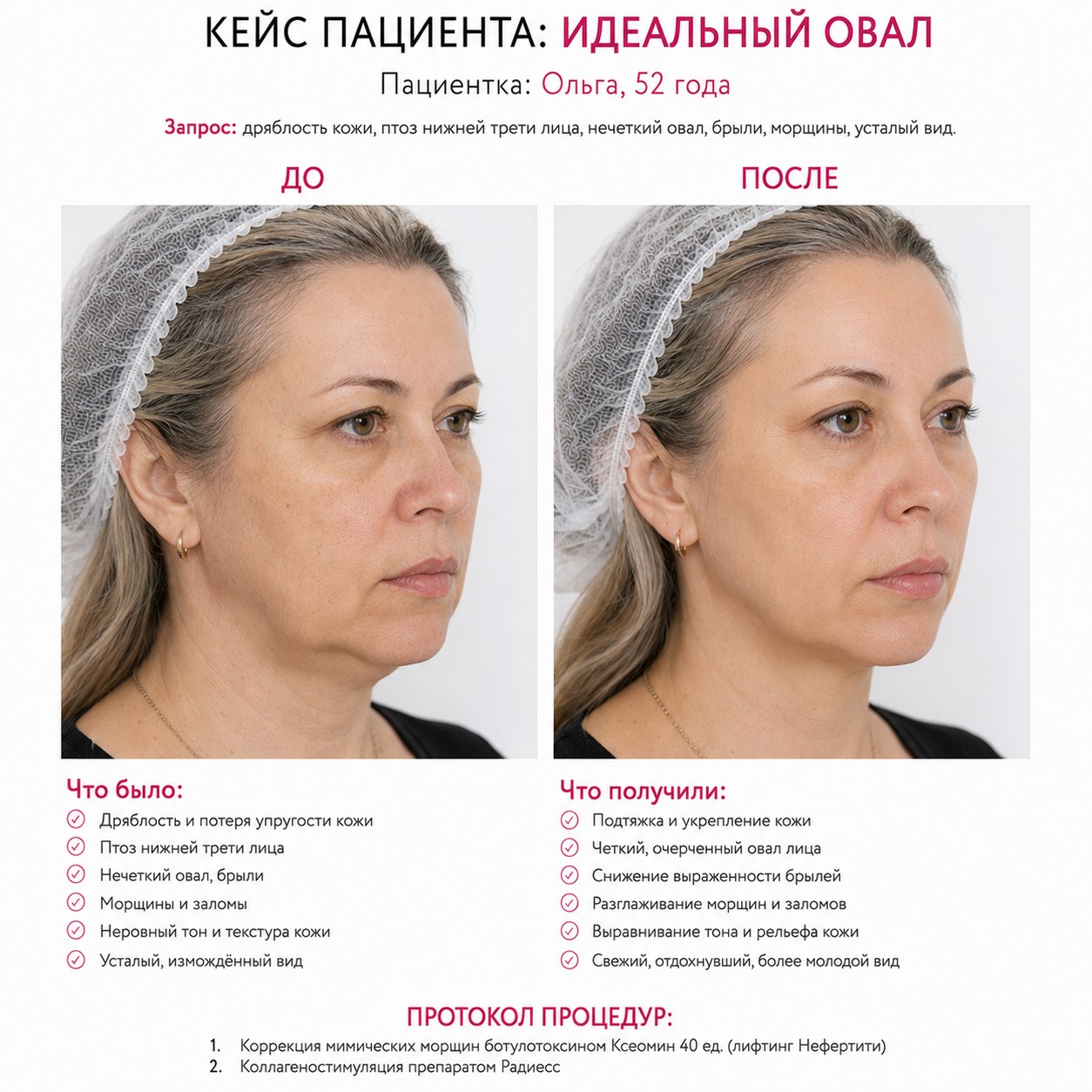 Кейс пациента до и после