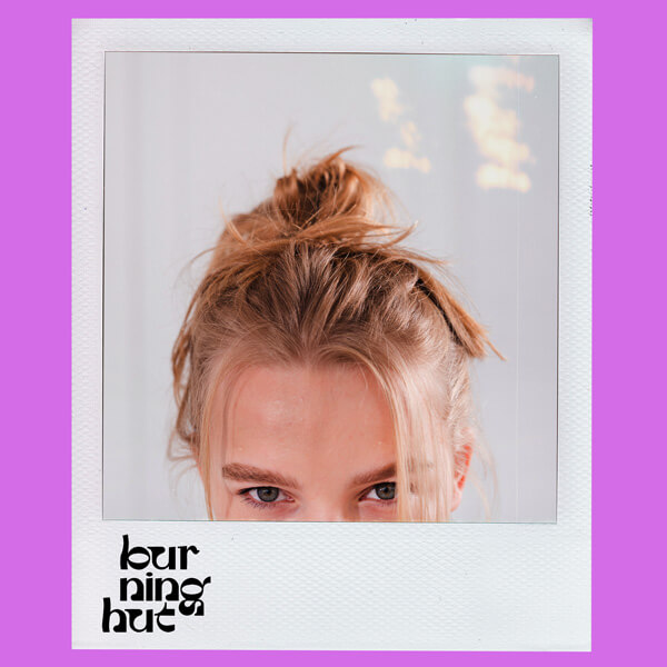 Проблемы с кожей в подростковом возрасте