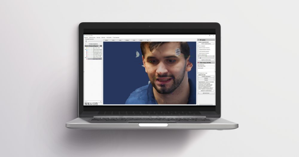Proaxis Ii Оптический аксиограф Proaxis