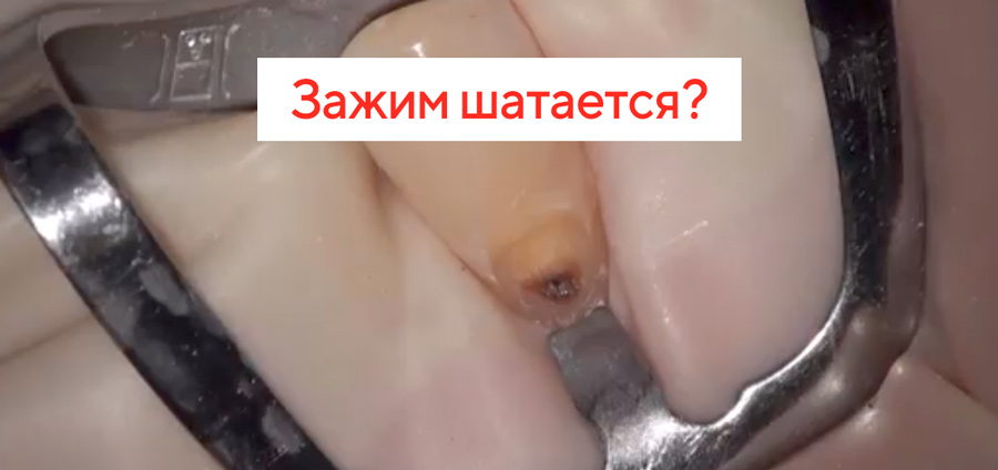 Протокол полировки.