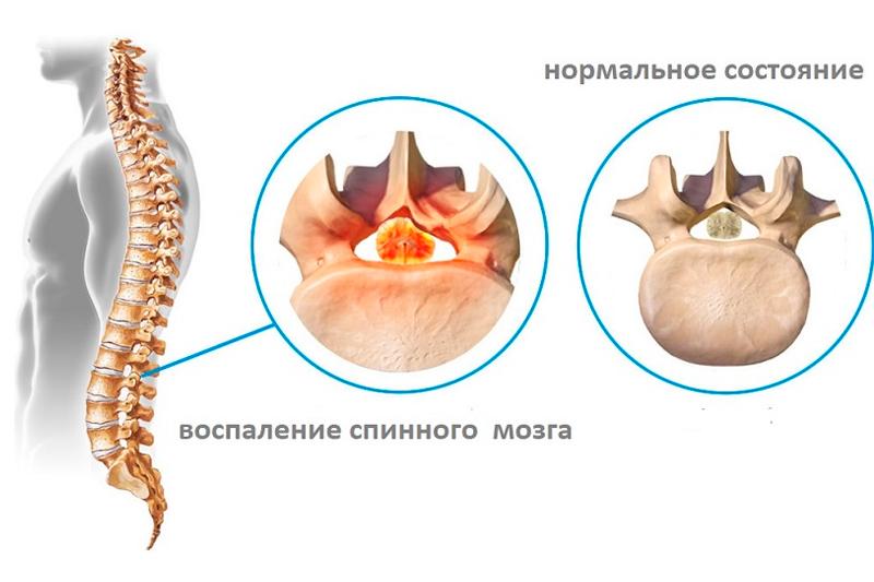 Спинной мозг неврология презентация