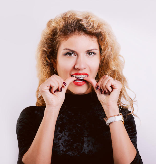 Зубные элайнеры в Москве. Установка элайнеров в Москве.