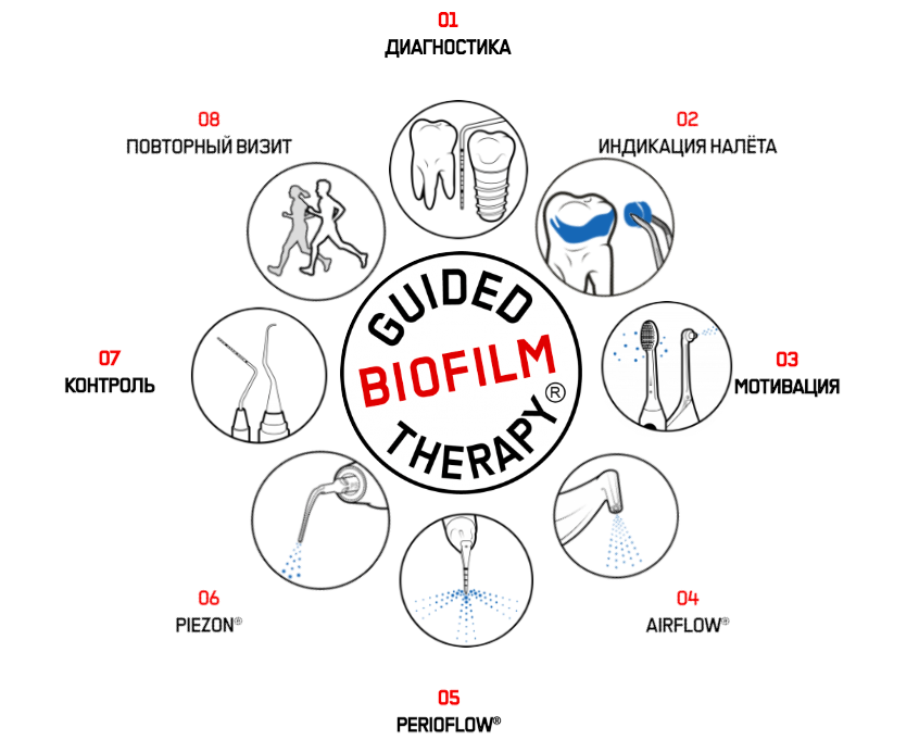 Gbt. GBT протокол профессиональной гигиены. Протокол GBT В стоматологии. Guided biofilm Therapy. Гигиена по протоколу GBT.