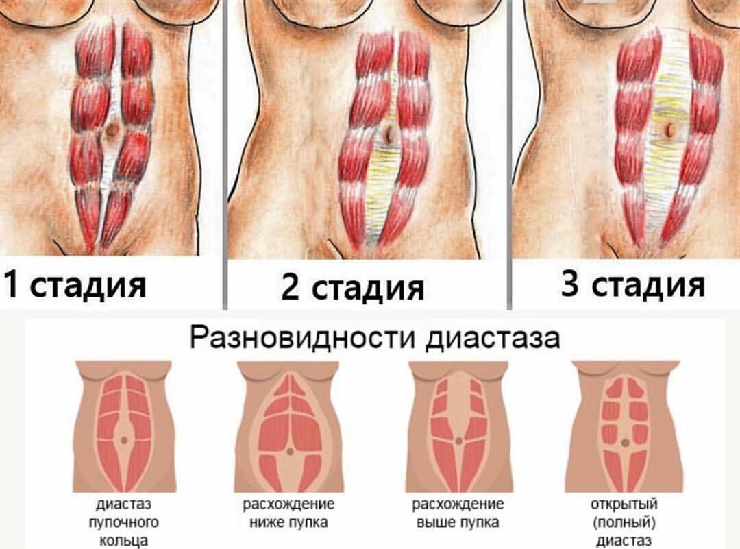 Секс после родов