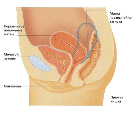 Пять вещей, которые нужно знать о вагине