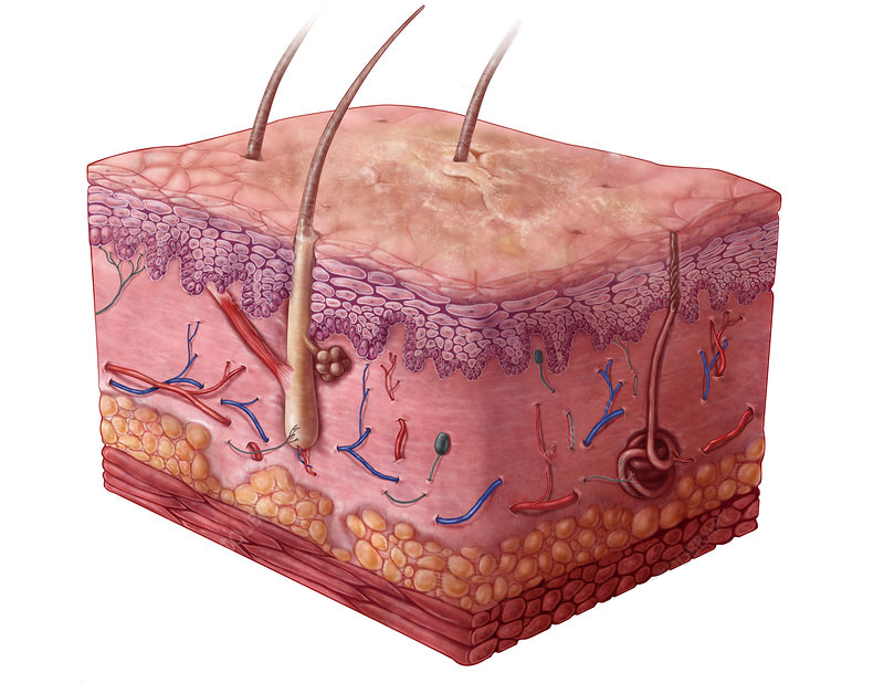 Actinic keratosis: photos, symptoms, treatment