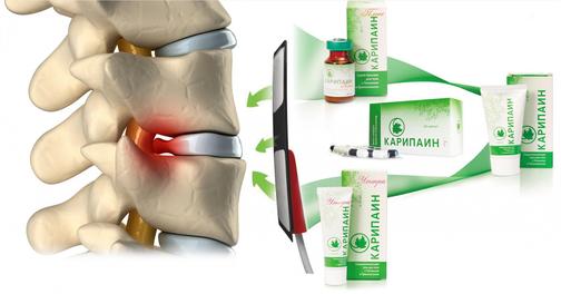 Нужно ли лечить межпозвоночную грыжу диска? Как лечить?