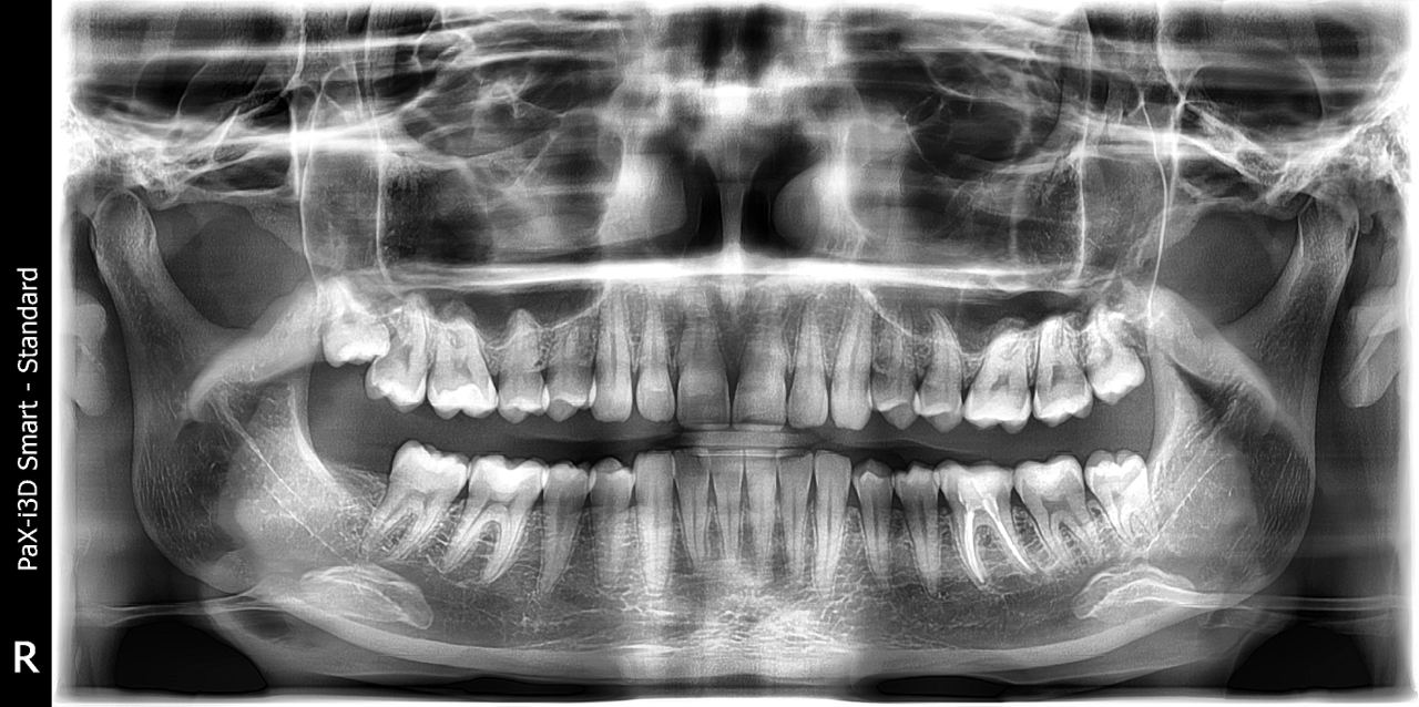 Панорамный снимок зубов в клинике "Viva Smile" в Москве