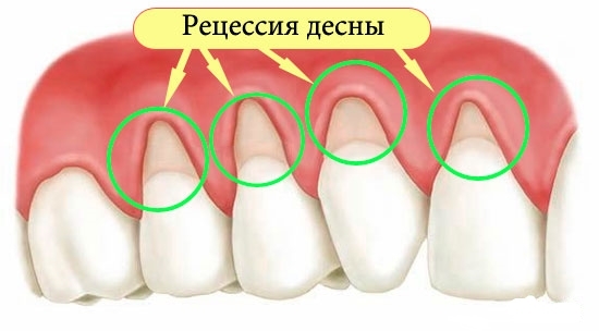 Гингивит : справочник стоматологических заболеваний