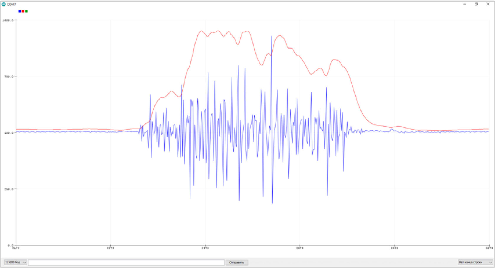 Overview of the EMG/ECG signal registration module MYO v1.4