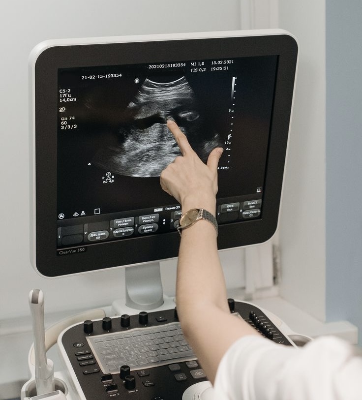 Внимательный врач проводит УЗИ-диагностику донору