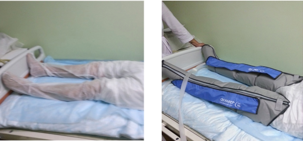 Пневмомассаж верхних и нижних конечностей