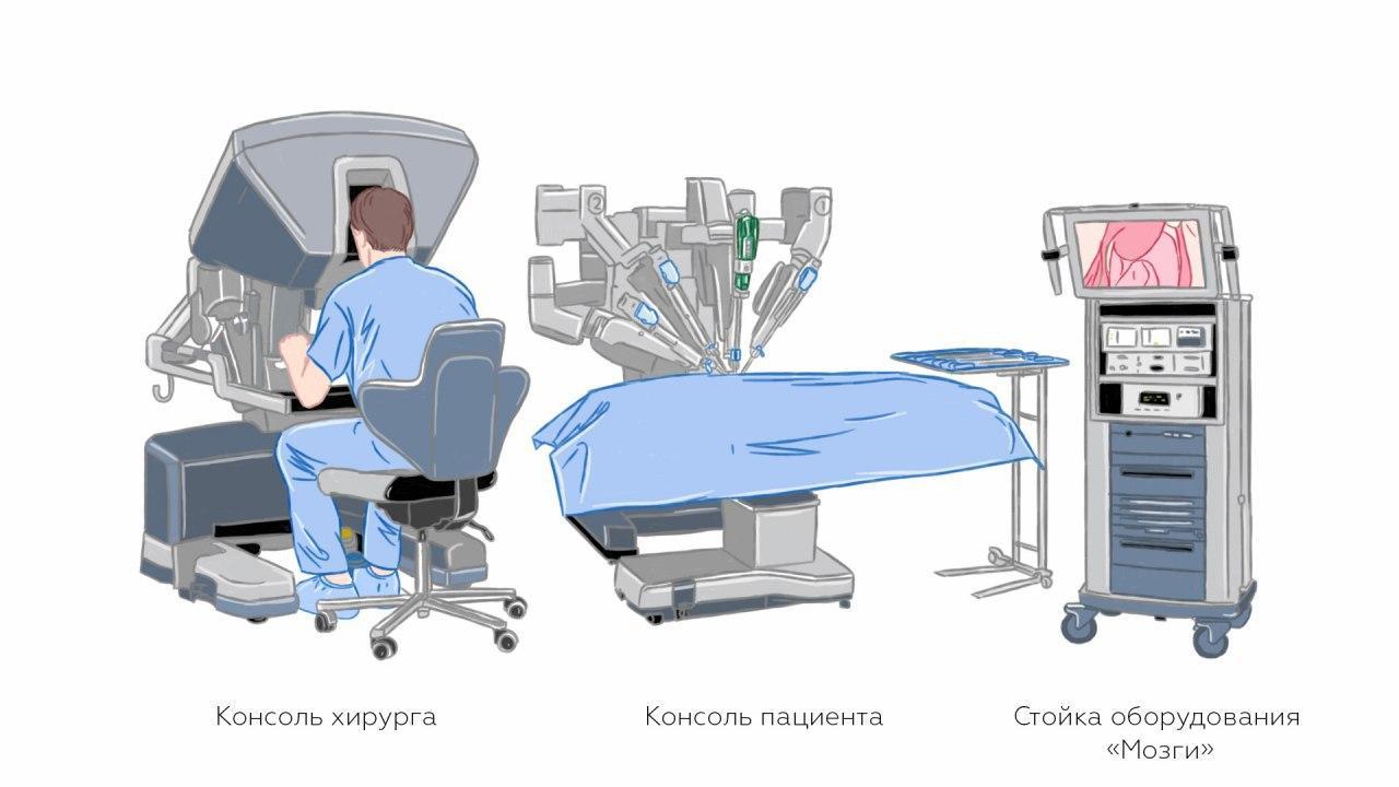 ЛАПАРОСКОПИЯ