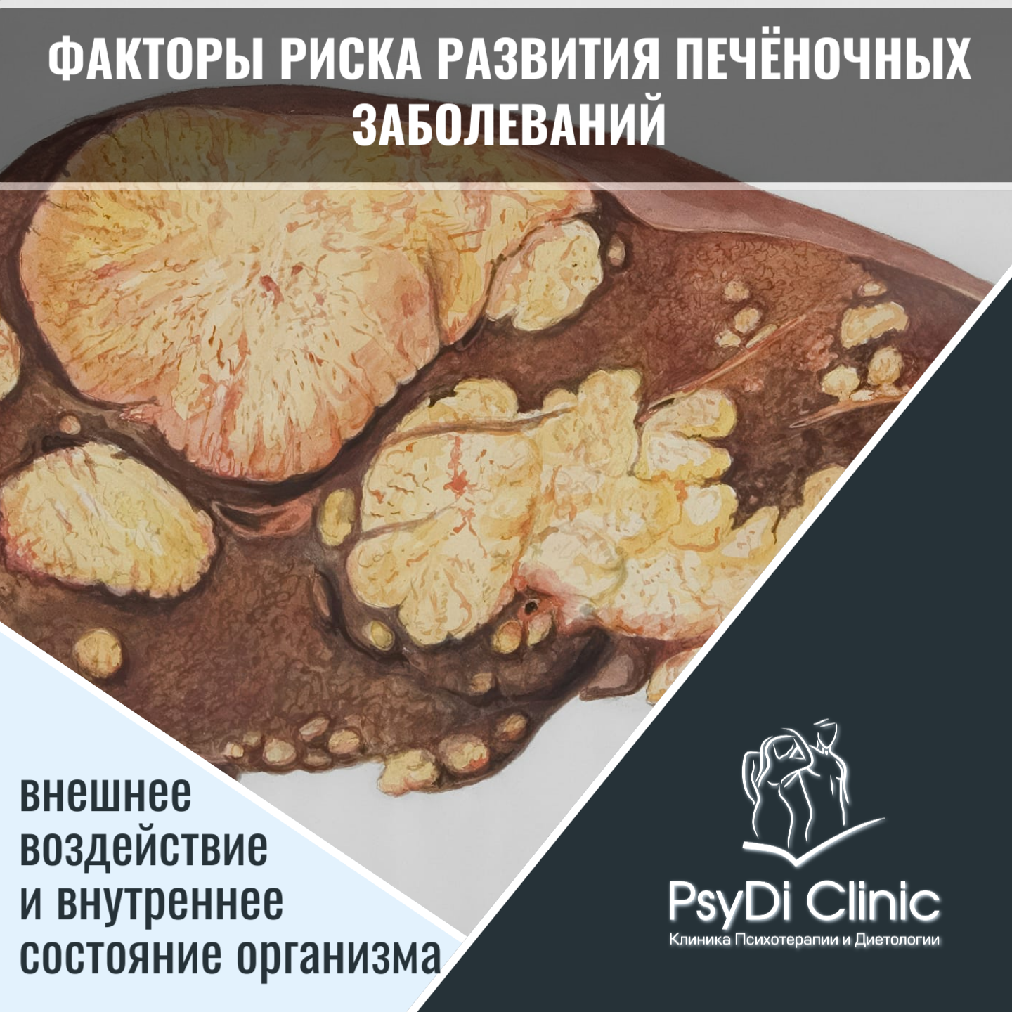 Факторы риска развития печёночных заболеваний: внешнее воздействие и внутреннее состояние организма ��
