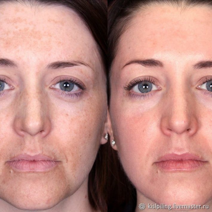 Услуги косметолога в Наро-Фоминске Услуги Авито